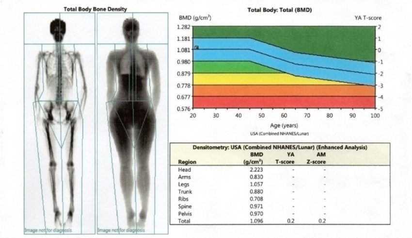 Benefits of a DEXA Body Fat Scan